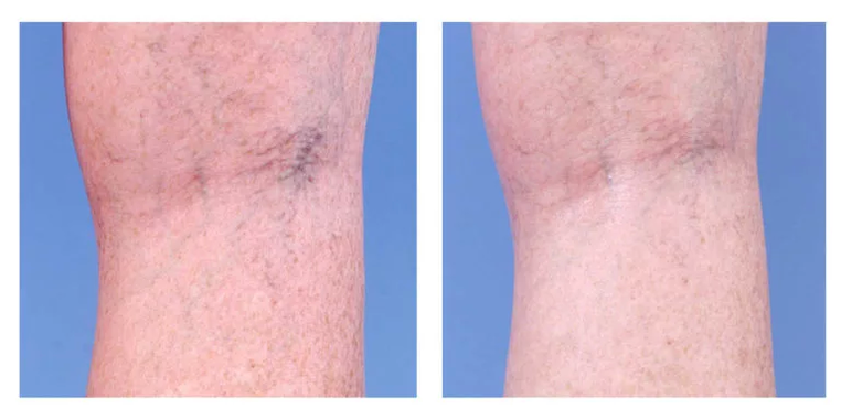 Correction cosmétique